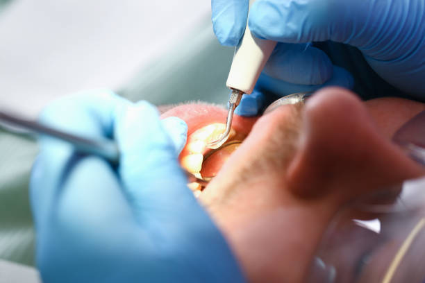 Best Emergency Cosmetic Dentistry (e.g., broken veneers) in Glennville, GA