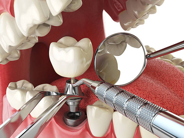 Best Emergency Dental Care for Sports Injuries in Glennville, GA
